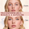 Ondulator de Gene Electric
