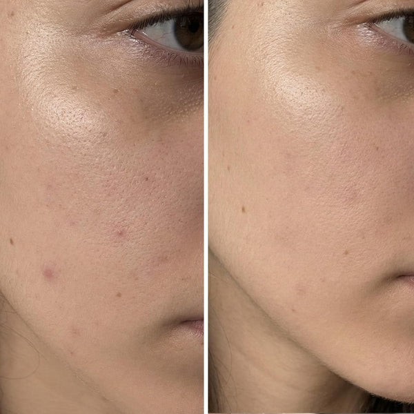 Scrub Facial Revigorant cu Aminoacizi